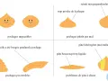 Guide visuel des problèmes courants lors de la préparation de la pâte à choux : formes réussies, trop proches, mal mélangées ou trop liquides.